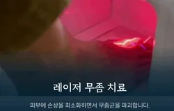 통합/랜딩/발톱/내성발톱/1만원/250421